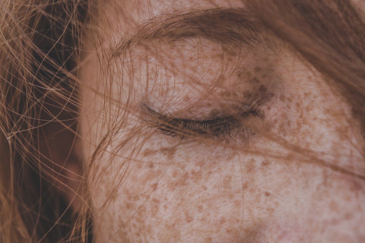 Skin before the radiance ritual — natural texture